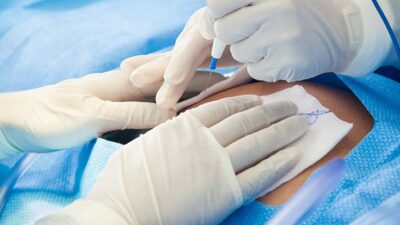 surgical team preps pregnant patient for cesarian section operation