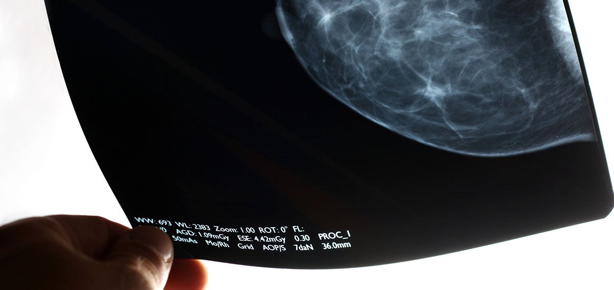 Delaying Mammograms During COVID-19 Means Women Must Know Their